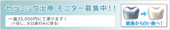 セラミック治療　モニター募集中！！